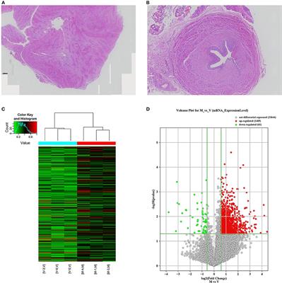 N6-Methyladenosine Methylomic Landscape of Ureteral Deficiency in Reflux Uropathy and Obstructive Uropathy